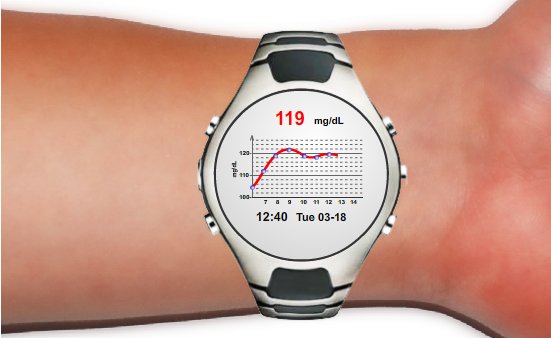 iwatch blood sugar monitor